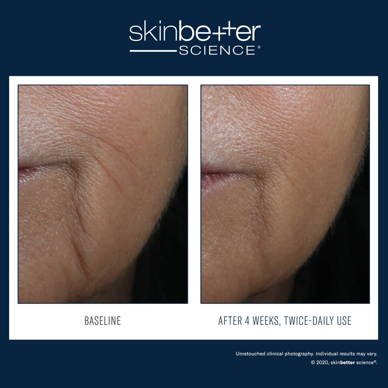 SkinBetter InterFuse Intensive Treatment LINES 15ml