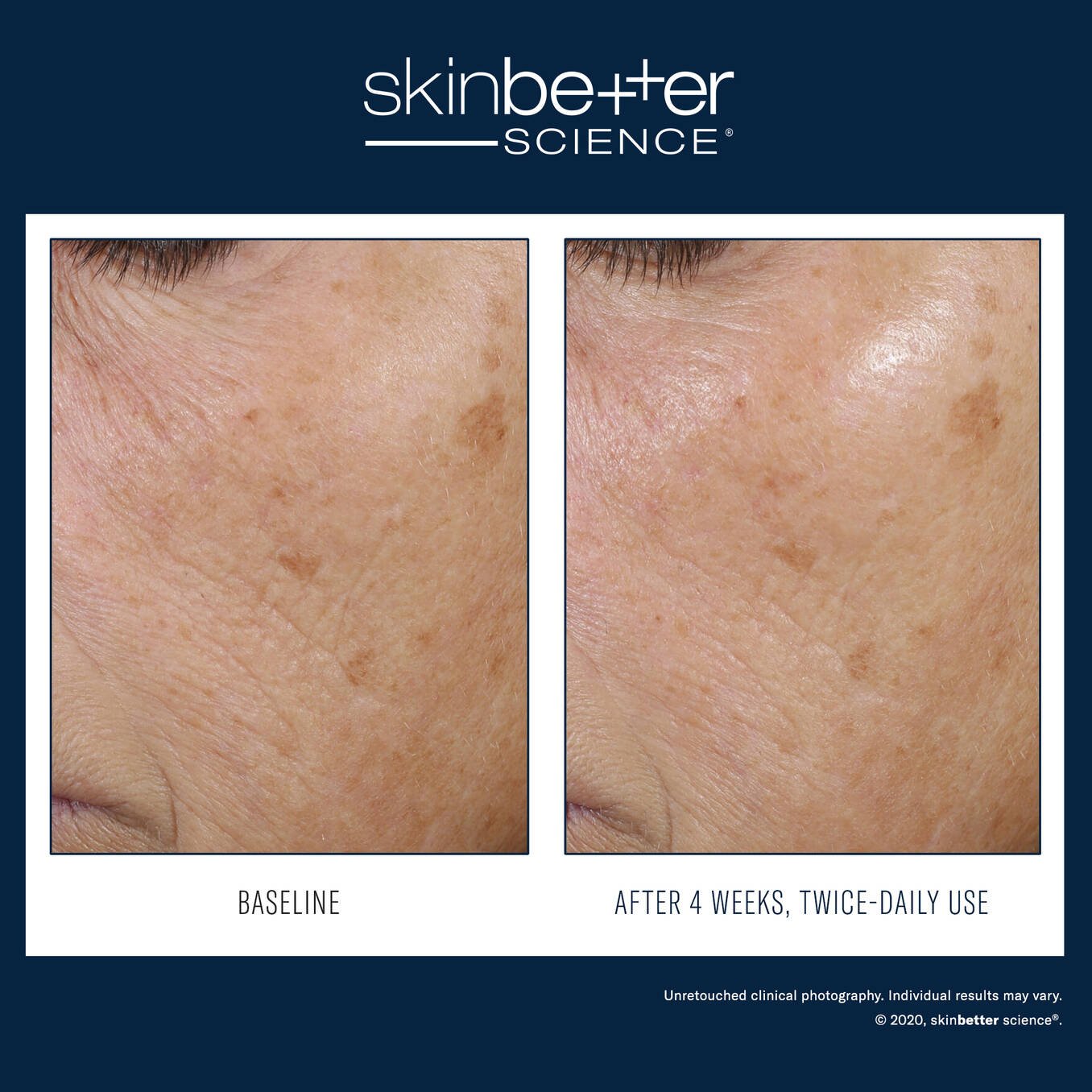 SkinBetter Trio Rebalancing Moisture Treatment 50ml