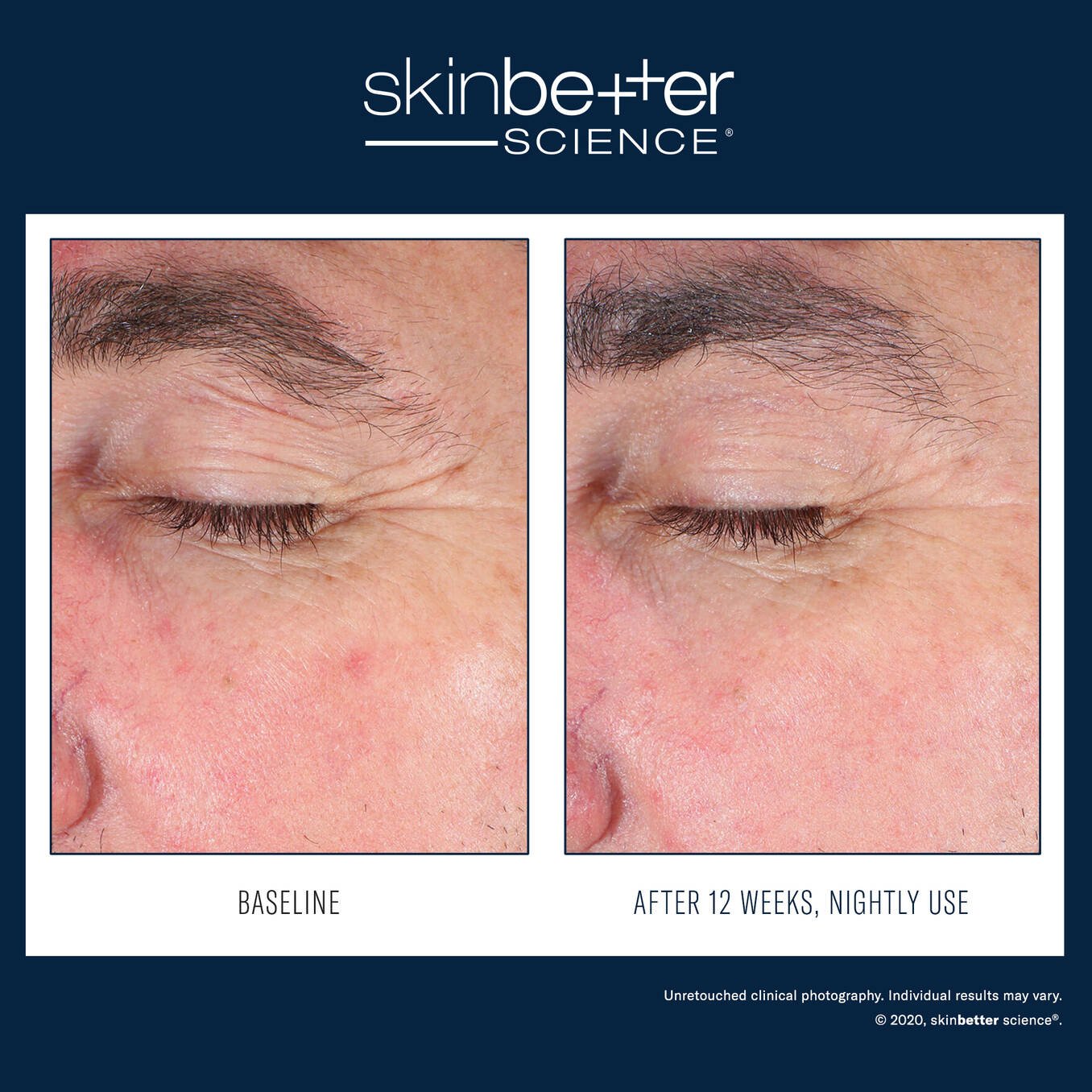 SkinBetter EyeMax AlphaRet Overnight Cream 15ml