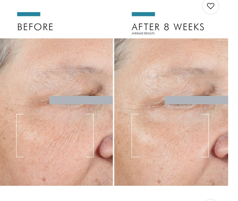 SkinCeuticals A.G.E. Advanced Eye