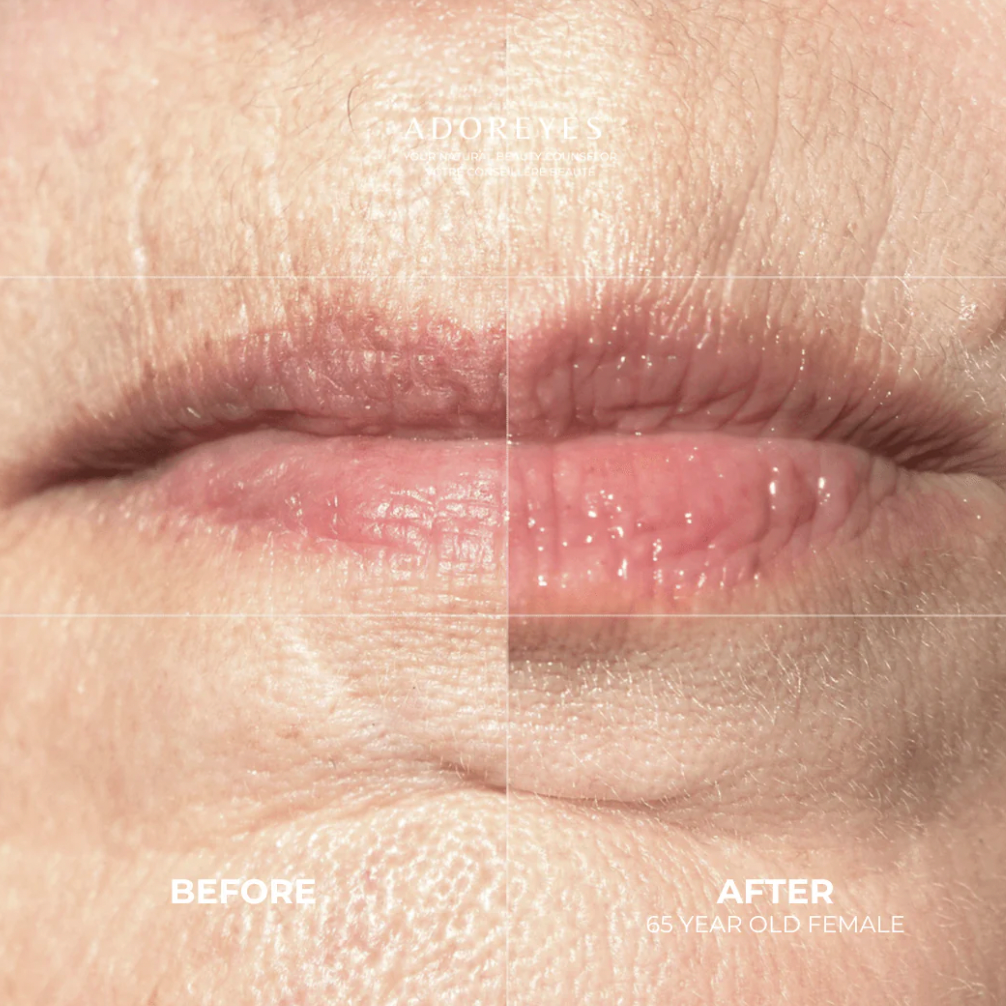 ADOREYES PepChat Biomimetic Lip Serum (10ml)